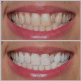 Ultraviolet Pearly Whites Brightening Gel